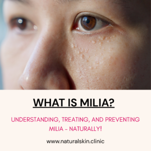 What Is Milia? Understanding, Treating, and Preventing Those Tiny White Bumps – the Natural way